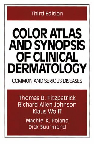 Color Atlas and Synopsis of Clinical Dermatology: Common and Serious Diseases