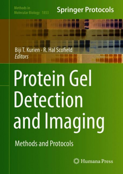 Protein Gel Detection and Imaging