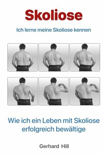 Skoliose: Ich lerne meine Skoliose kennen