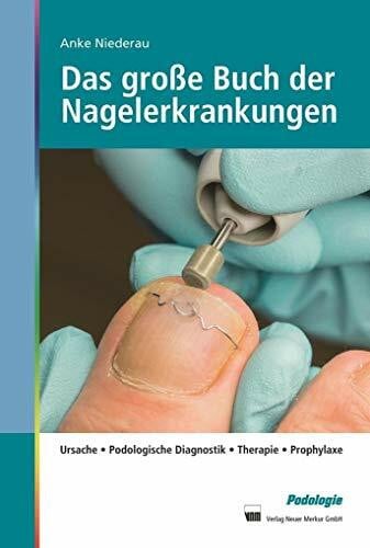 Das große Buch der Nagelerkrankungen: Ursache, Podologische Diagnostik, Therapie, Prophylaxe