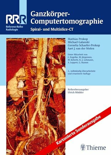 Ganzkörper-Computertomographie: Spiral- und Multislice-CT (Referenz-Reihe Radiologie)