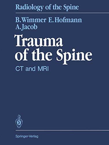 Trauma of the Spine. CT and MRI Trauma of the Spine. CT and MRI