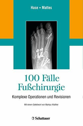 100 Fälle Fußchirurgie: Komplexe Operationen und Revisionen