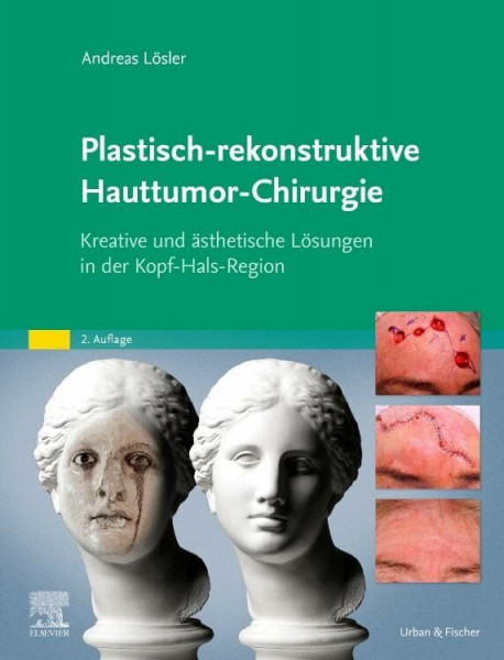 Plastisch-rekonstruktive Hauttumor-Chirurgie: Kreative und ästhetische Lösungen in der Kopf-Hals-Region