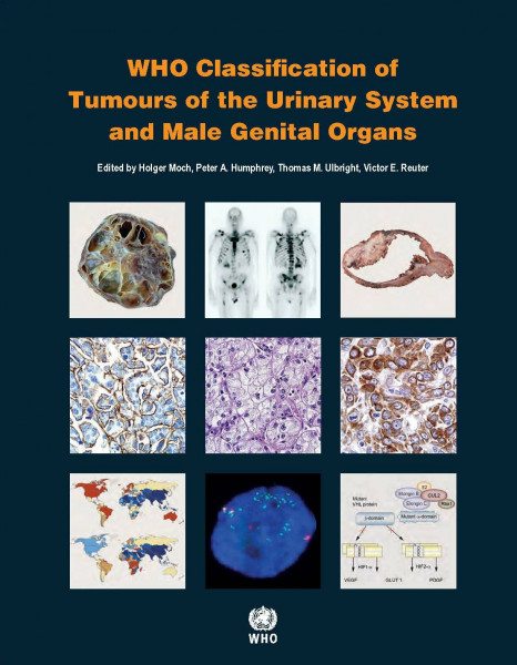 WHO Classification of Tumours of the Urinary System and Male Genital Organs (World Health Organization Classification of Tumours, Band 8)