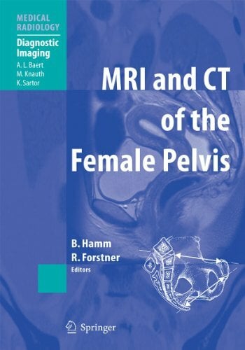 MRI and CT of the Female Pelvis (Medical Radiology) MRI and CT of the Female Pelvis (Medical Radiology)