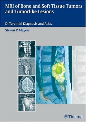 MRI of Bone and Soft Tissue Tumors and Tumorlike Lesions: Differential Diagnosis and Atlas MRI of Bone and Soft Tissue Tumors and Tumorlike Lesions: Differential Diagnosis and Atlas