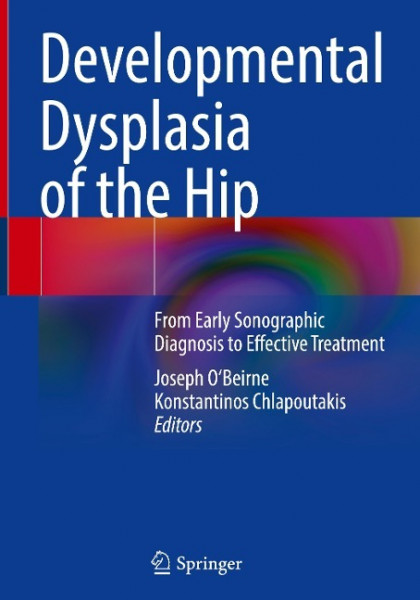 Developmental Dysplasia of the Hip