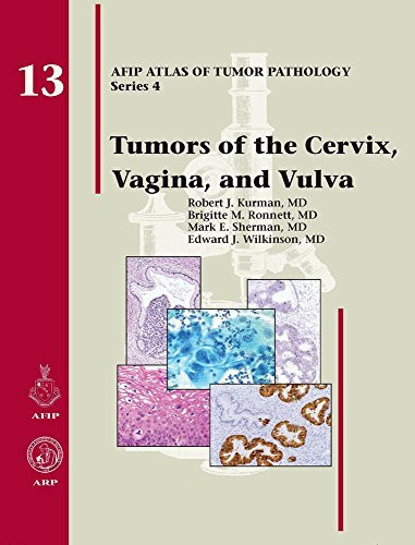 Tumors of the Cervix, Vagina, and Vulva (AFIP Atlas of Tumor Pathology, Series 4,)