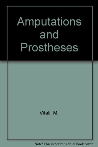 Amputations and Prostheses Amputations and Prostheses