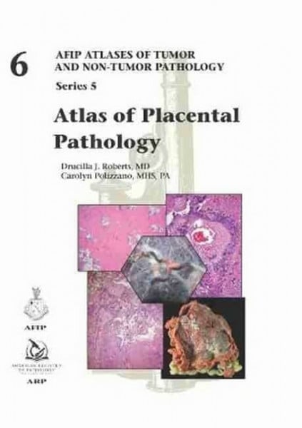 Atlas of Placental Pathology (AFIP Atlas of Tumor and Non-Tumor Pathology, Series 5, Band 6)