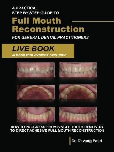 A Practical Step By Step Guide to Full Mouth Reconstruction for General Dental Practitioners: How to Progress From Single Tooth Dentistry To Direct Adhesive Full Mouth Reconstruction