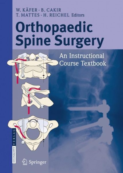 Orthopaedic Spine Surgery