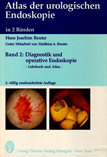 Atlas der Urologischen Endoskopie II. Diagnostik und operative Endoskopie