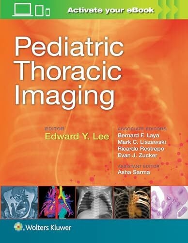 Pediatric Thoracic Imaging
