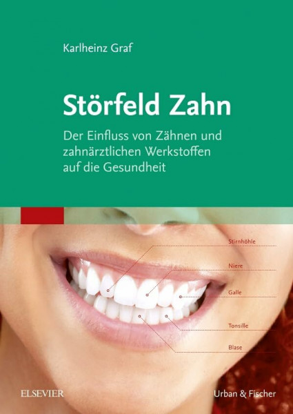 Störfeld Zahn: Der Einfluss von Zähnen und zahnärztlichen Werkstoffen auf die Gesundheit