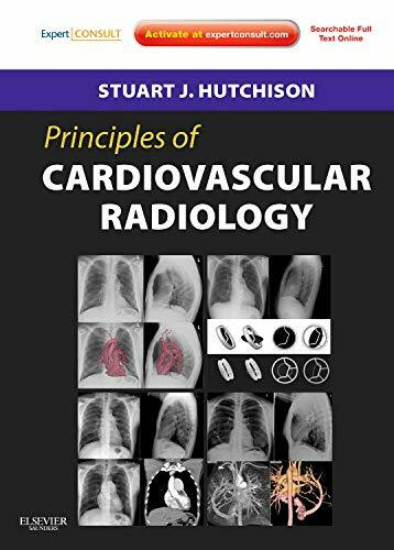 Principles of Cardiovascular Radiology: Expert Consult (Principles of Cardiovascular Imaging)