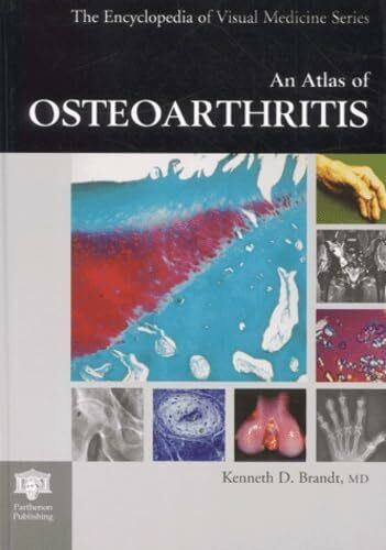An Atlas of Obsteoarthritis (The Encyclopedia of Visual Medicine)