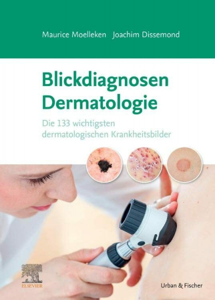 Blickdiagnosen Dermatologie: Die 133 wichtigsten dermatologischen Krankheitsbilder