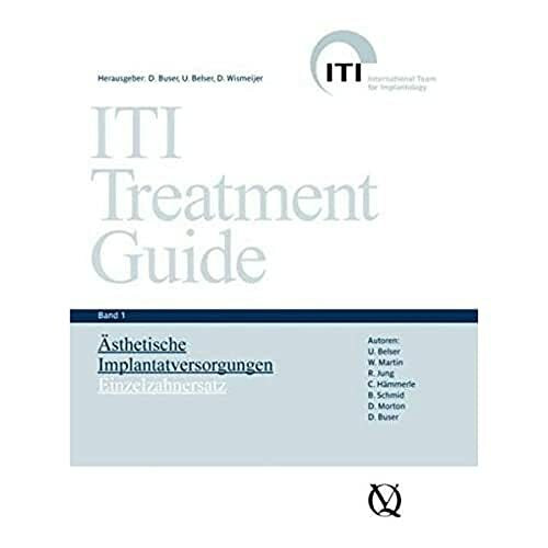 ITI Treatment Guide Band 1: Ästhetische Implantattherapie: Einzelzahnersatz (ITI Treatment Guide: Deutsche Ausgabe)