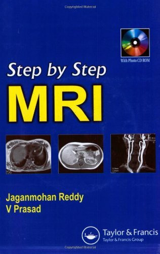 Step By Step MRI