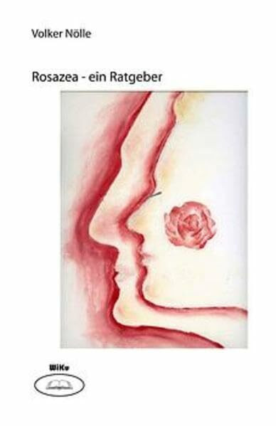 Rosazea: Ein Ratgeber
