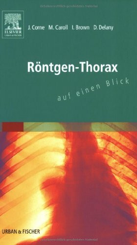 Röntgen-Thorax auf einen Blick