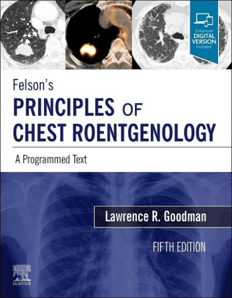 Felson's Principles of Chest Roentgenology, A Programmed Text