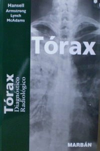 Tórax : diagnóstico radiológico