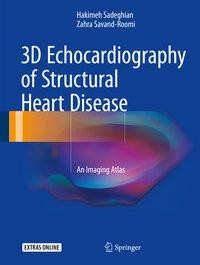 3D Echocardiography of Structural Heart Disease