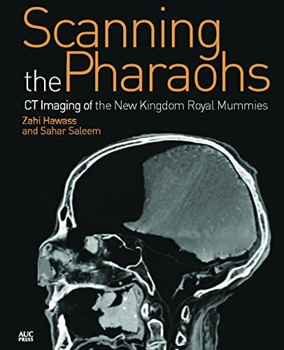 Scanning the Pharaohs: CT Imaging of the New Kingdom Royal Mummies