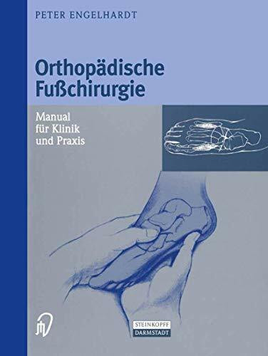 Orthopädische Fußchirurgie. Manual für Klinik und Praxis