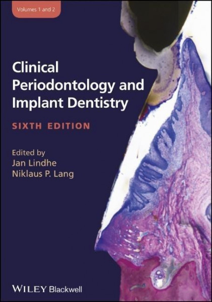 Clinical Periodontology and Implant Dentistry, 2 Volume Set