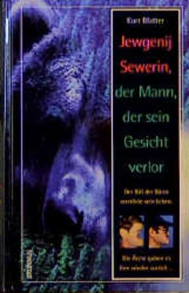 Jewgenij Sewerin - der Mann, der sein Gesicht verlor: Der Biss einer Bärin zerstörte sein Leben. Die Ärzte gaben es ihm wieder zurück...