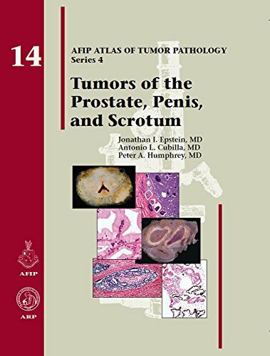 Tumors of the Prostate Gland, Seminal Vesicles, Penis, and Scrotum (AFIP Atlas of Tumor Pathology: Series 4)
