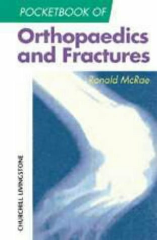 Pocketbook of Orthopaedics and Fractures (Churchill Pocketbooks)