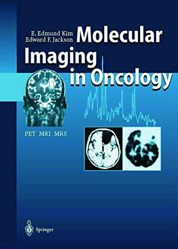 Molecular Imaging in Oncology: PET, MRI, and MRS