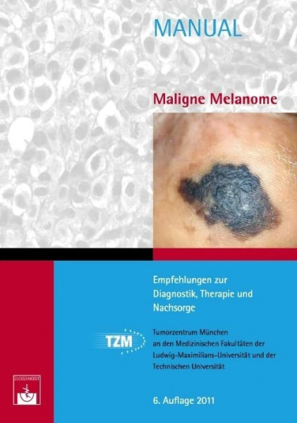 Maligne Melanome: Empfehlungen zur Diagnostik, Therapie und Nachsorge (Manuale Tumorzentrum München)