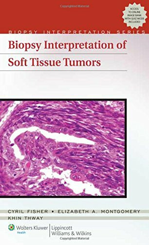 Biopsy Interpretation of Soft Tissue Tumors (Biopsy Interpretation Series)