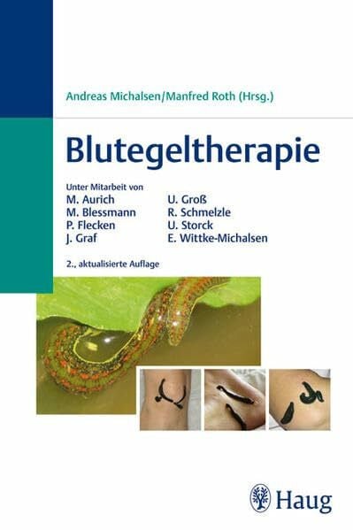 Blutegeltherapie