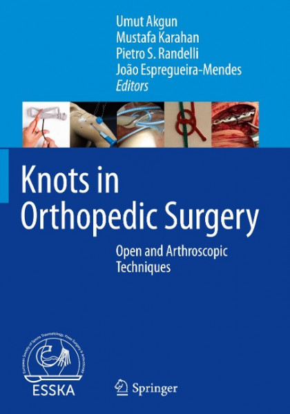 Knots in Orthopedic Surgery