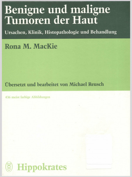 Benigne und maligne Tumoren der Haut. Ursachen, Klinik, Histopathologie und Behandlung