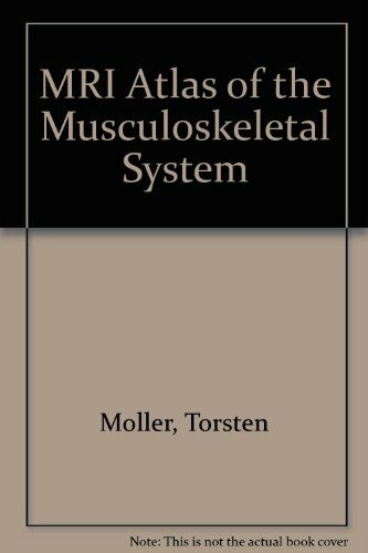 Mri Atlas of the Musculoskeletal System