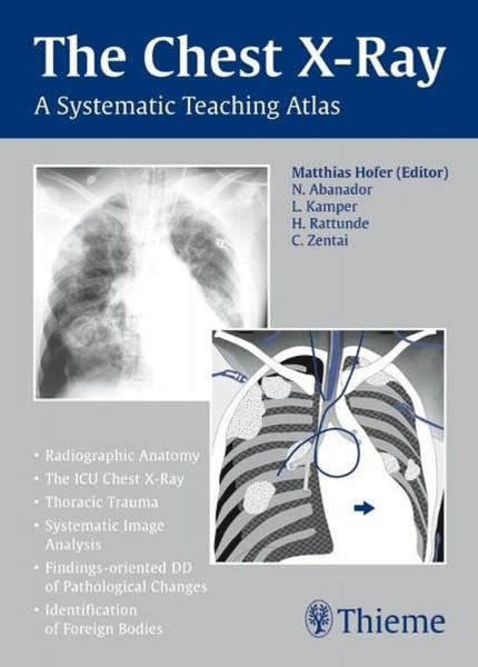 The Chest X-Ray: A Systematic Teaching Atlas
