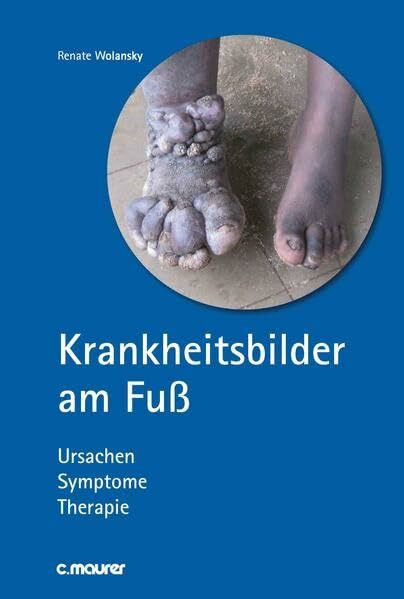 Krankheitsbilder am Fuß