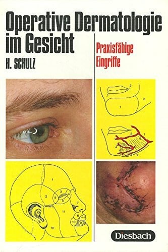 Operative Dermatologie im Gesicht: Praxisfähige Eingriffe