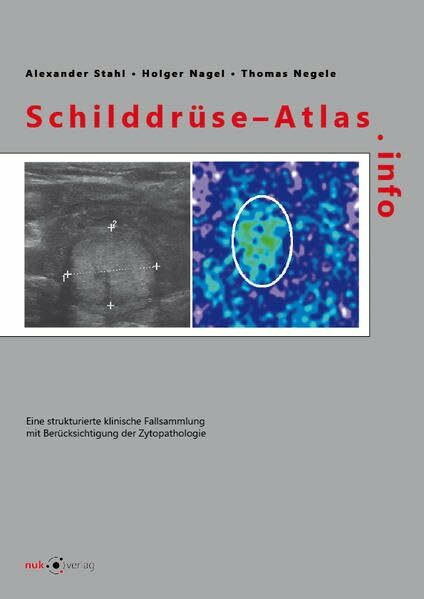Schilddrüse-Atlas.info: Eine strukturierte klinische Fallsammlung mit Berücksichtigung der Zytopathologie