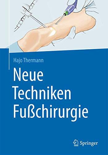 Neue Techniken Fußchirurgie Neue Techniken Fußchirurgie