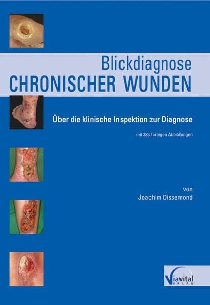 Blickdiagnose chronischer Wunden: Über die klinische Inspektion zur Diagnose