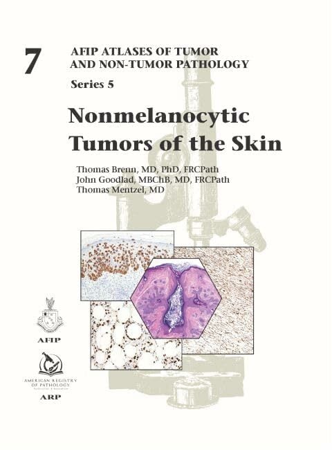 Nonmelanocytic Tumors of the Skin (AFIP Atlas of Tumor and Non-Tumor Pathology, Series 5, Band 7) Nonmelanocytic Tumors of the Skin (AFIP Atlas of Tumor and Non-Tumor Pathology, Series 5, Band 7)